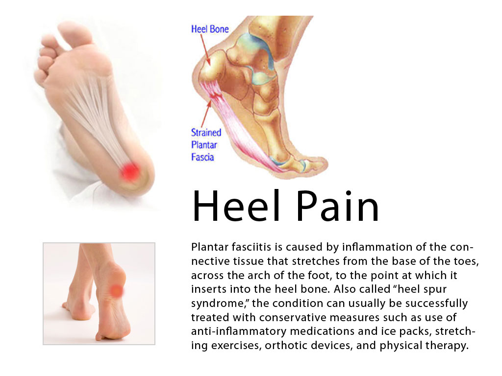pain in middle of heel
